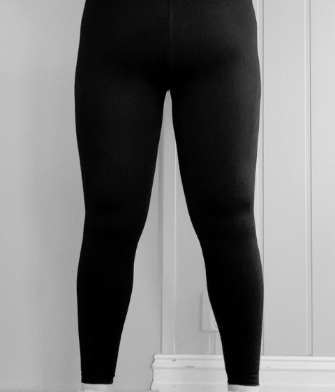 lipödem-före-efter